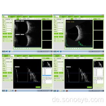 Tragbarer ophthalmischer A / B-Scanner